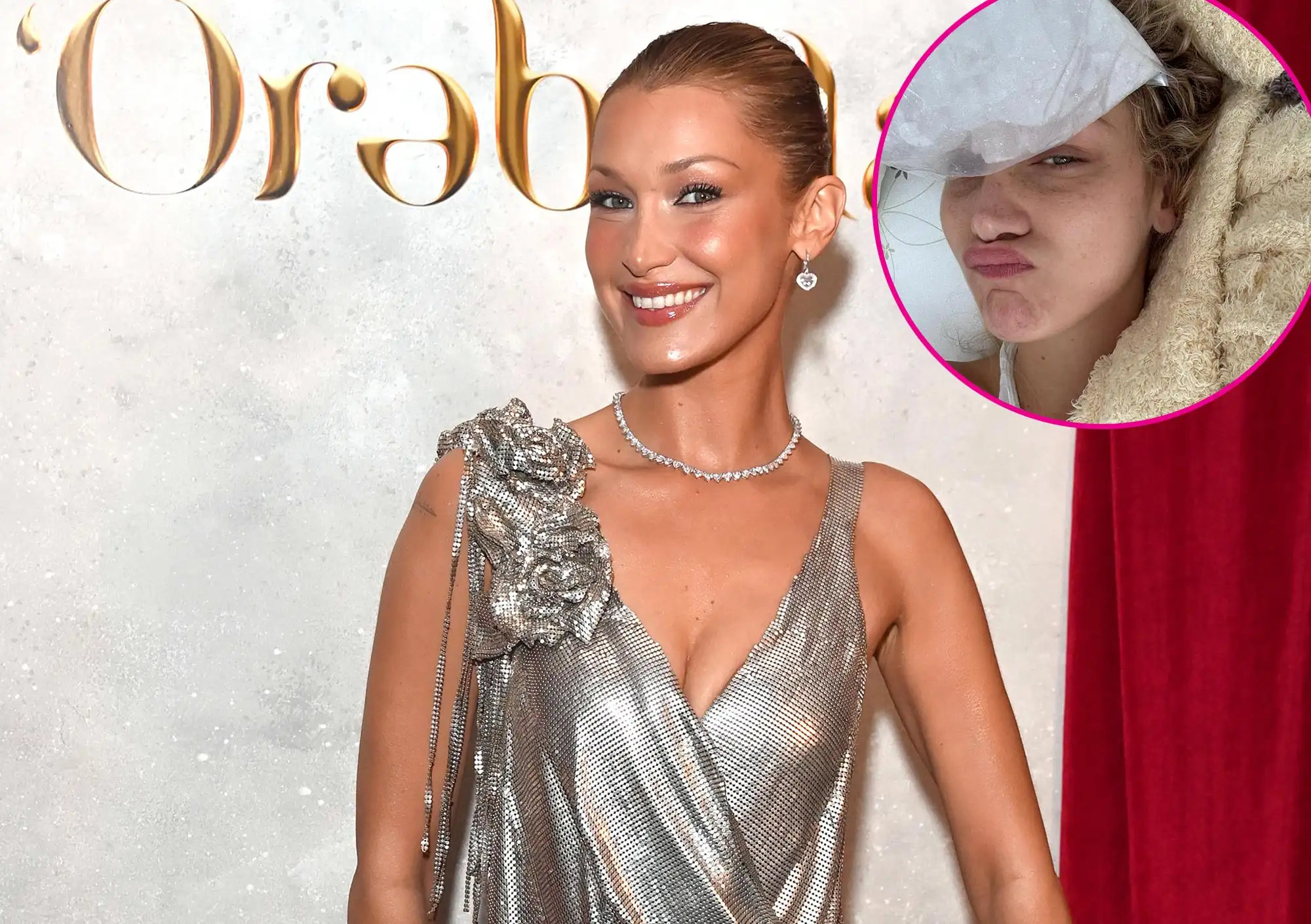 Hastane odasından paylaşım yapmıştı… Bella Hadid hasta değil iddiası!